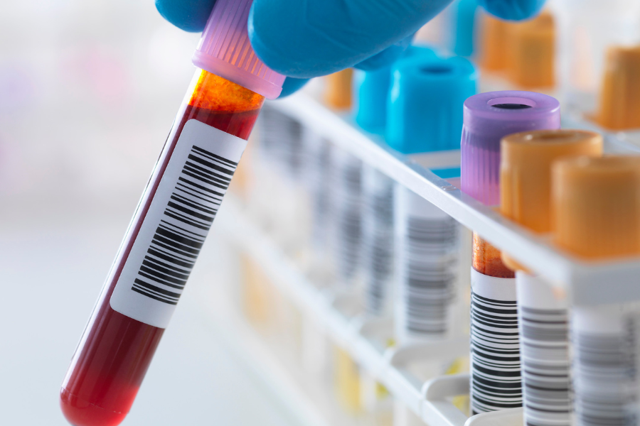 A gloved hand selects a blood sample from a vial case and holds it up.